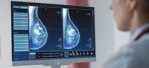 A doctor looks at a breast screening.