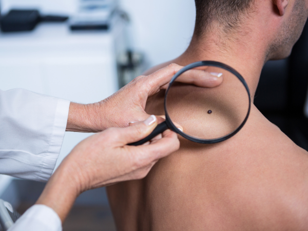 A man getting a skin check