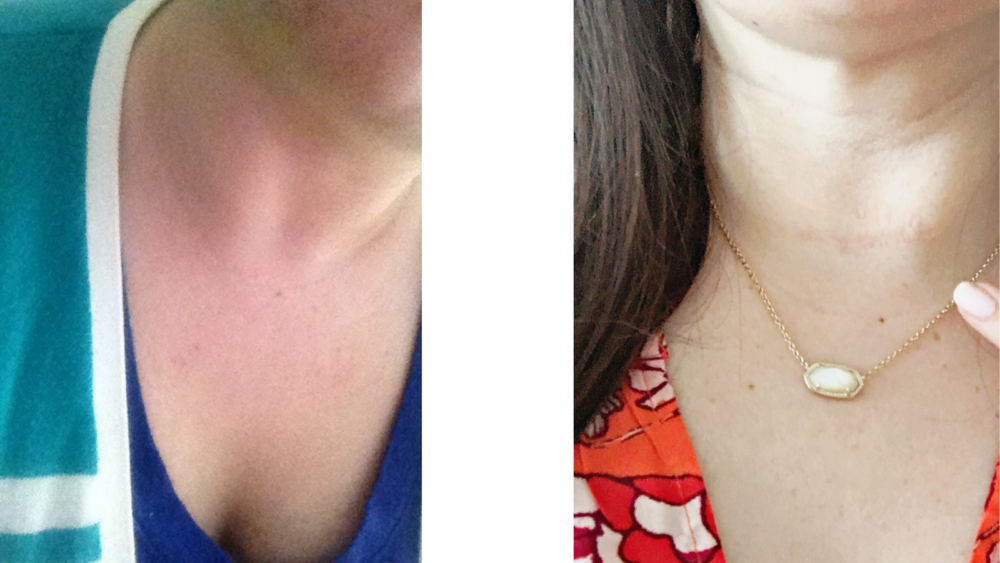 Close up image of a woman's neck area.