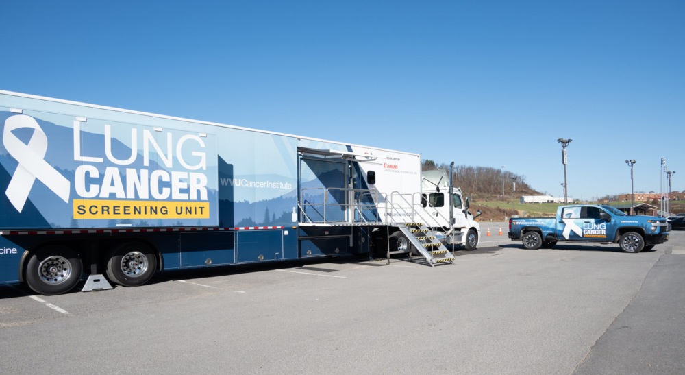 Outside on a bright day with a blue sky, There is a mobile lung cancer screening truck.