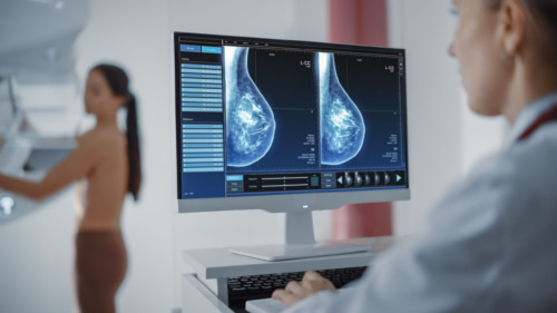 A doctor looks at a breast screening