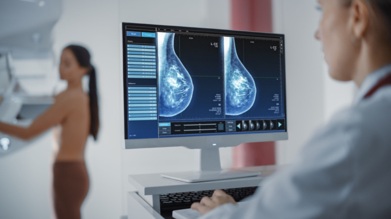 A doctor looks at a breast screening