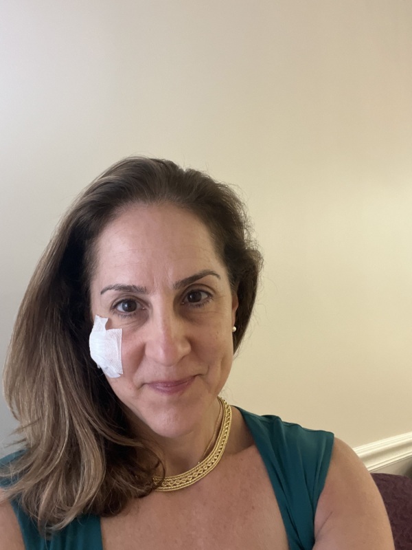 A selfie of Jody Hoyos, CEO of the Prevent Cancer Foundation, with a large bandage on her cheek.