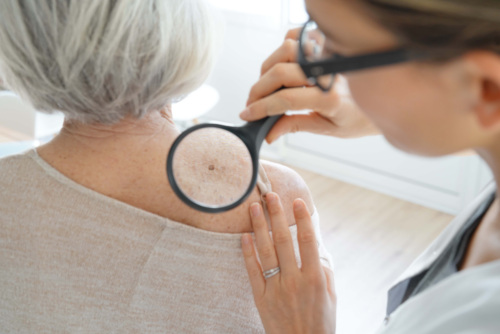 Older woman getting skin checked by dermatologist with magnifying glass held up to her back.