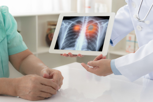 lung cancer doctor and patient